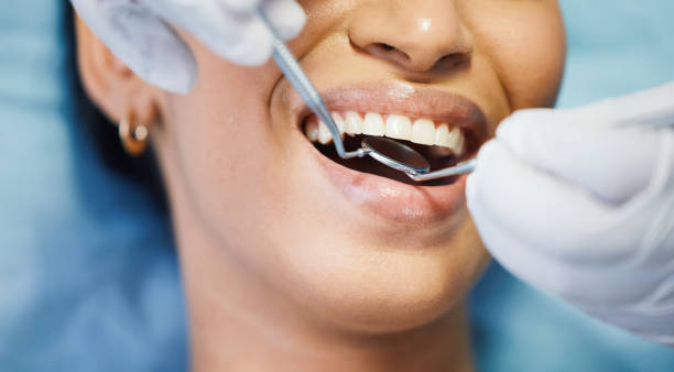 Teeth Whitening in WA